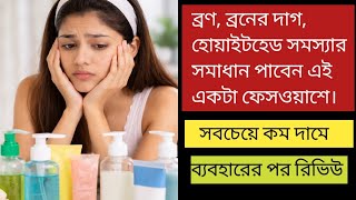 বরণ,বরণর দগ,বলযকহডস, থক মকত পত এই ফসওযশটই আপনর জনয যথষট বযবহরর পর রভউ