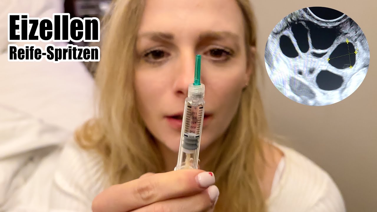 Erster Schritt fr unsere Knstliche Befruchtung (Kinderwunsch #2)