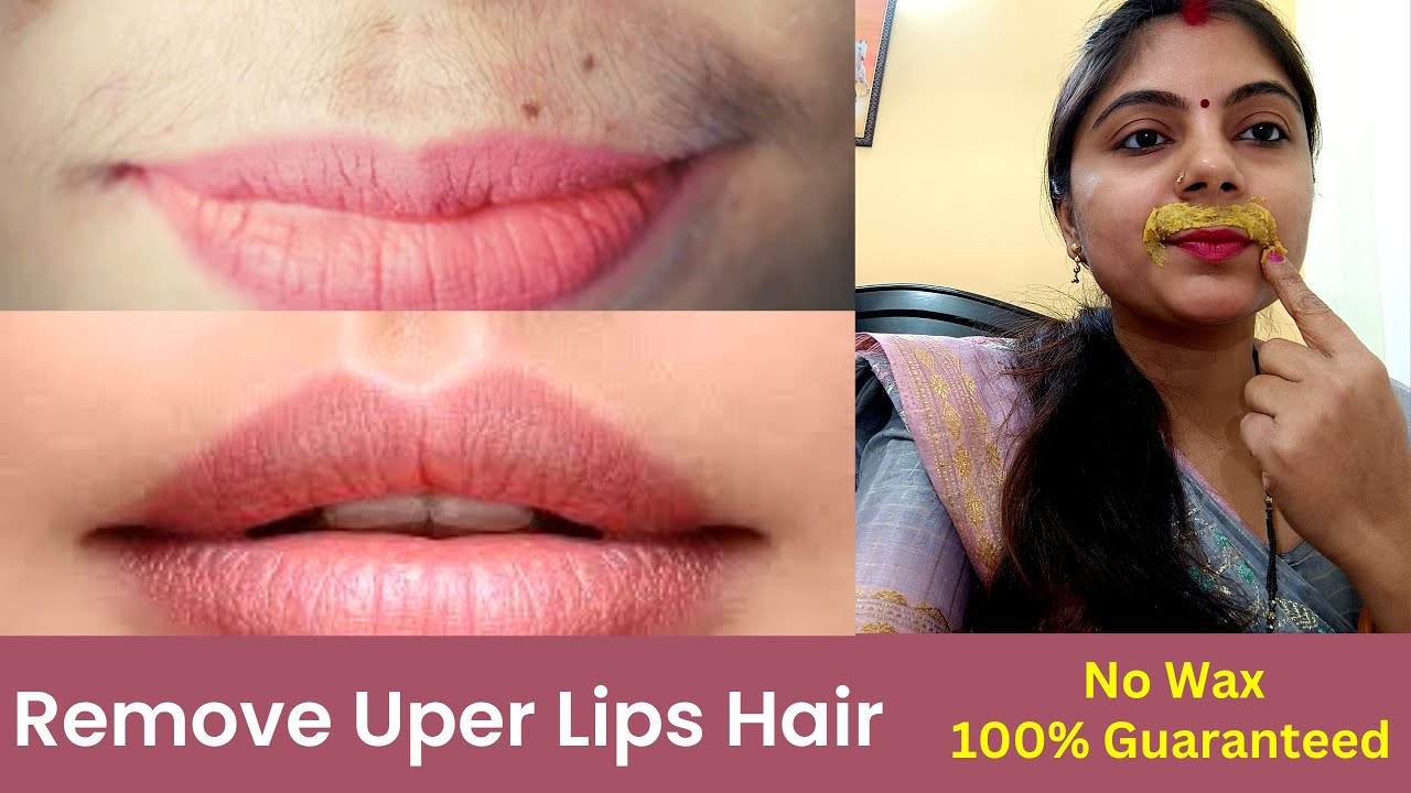 Permanently Remove Upper Lip Hair lips ke baal hatane ka best tarika upperliphairremoval