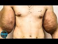 Top 10 Plastic Surgery Nightmares