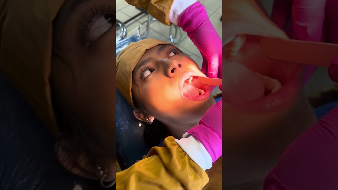 Exploracion física de la cavidad oral 