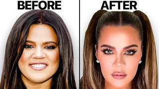 Khloe Kardashian NEW Face | Plastic Surgery Analysis