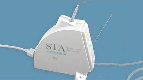 The Wand: Overview of the System