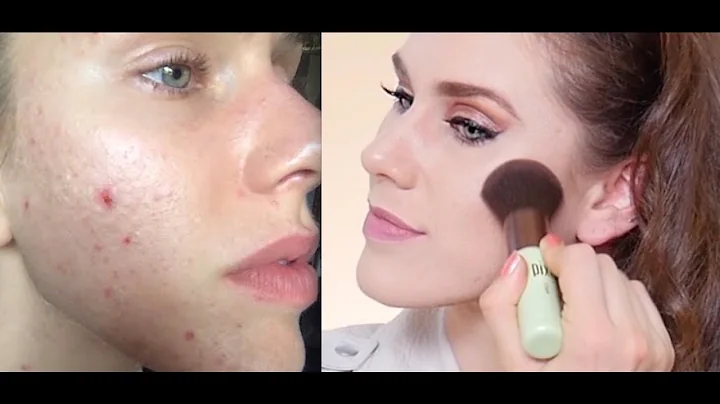 CHEEK ACNE Let's Talk Blush & Breakouts at Ipsy's ...