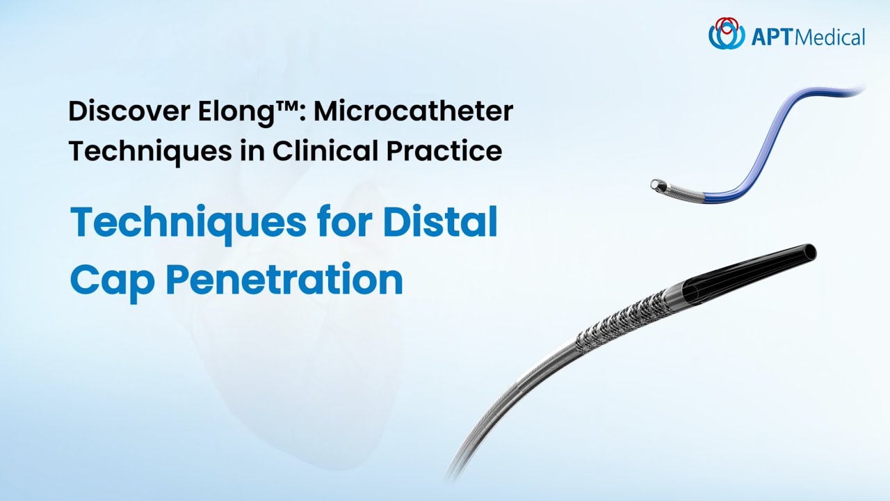 Discover Elong™ Microcatheter | Techniques for Distal Cap Penetration