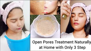 open pores treatment naturally at home in just 3 steps #shorts  #diy #skincare
