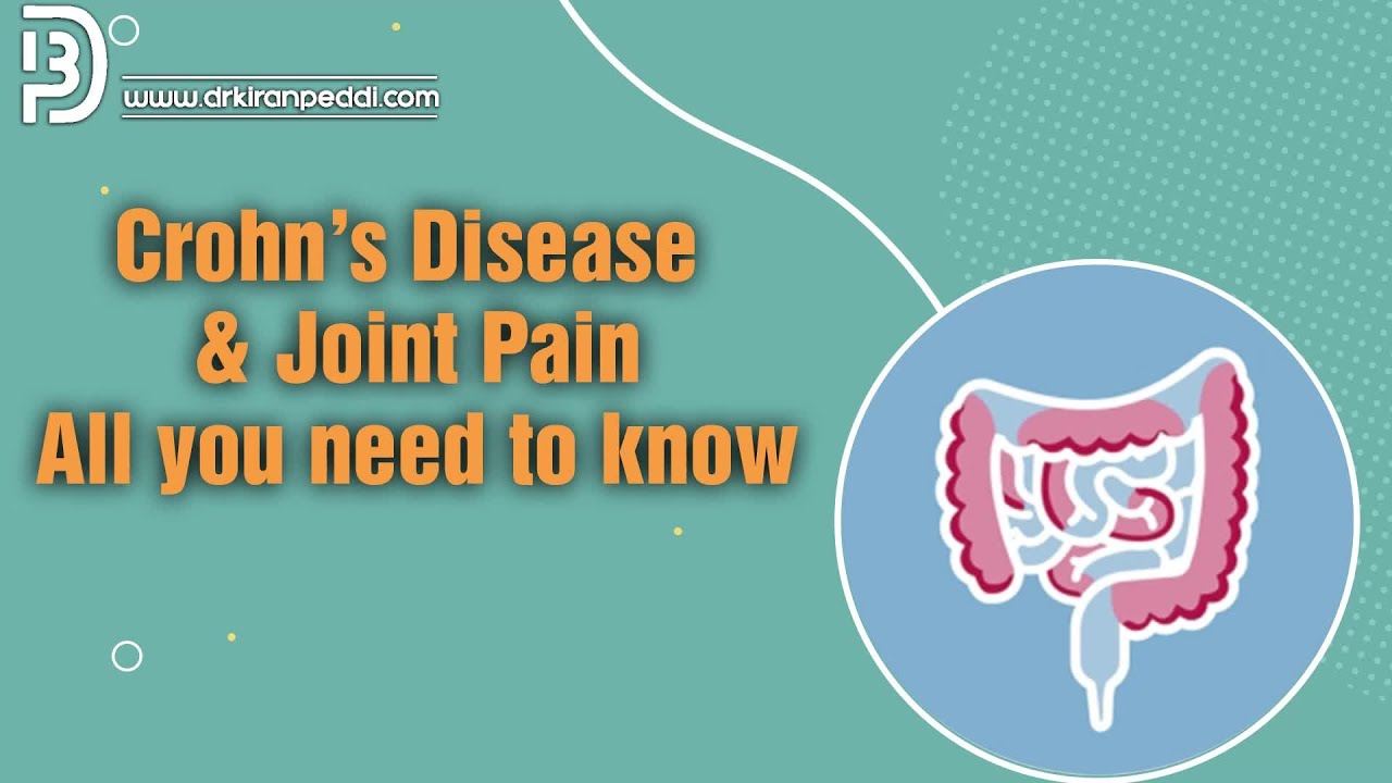 Crohn's Disease & Joint Pain All you Need to Know Dr Kiran Peddi YouTube