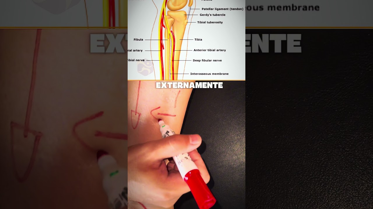 Ententa mais sobre a entorse em inversão do tornozelo