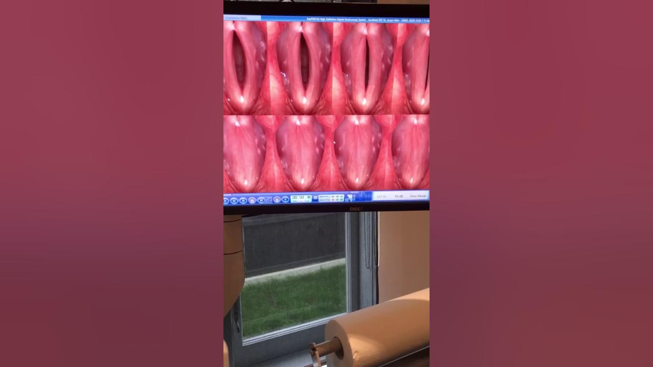 Pentax ENT Stroboscopy 9310HD YouTube