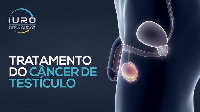 Espermatocele: o que é, sintomas, causas e tratamento - Tua Saúde