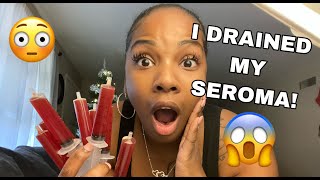 Draining My SEROMA 12 Days Post Op | My #BBL/360 Lipo Journey | Dr. Nosrati | New Life Cosmetics