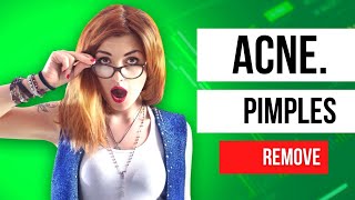 How To Remove Pimples Overnight | Acne Treatment