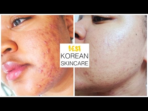 Best Korean Skincare | Healing sensitive acne-prone skin