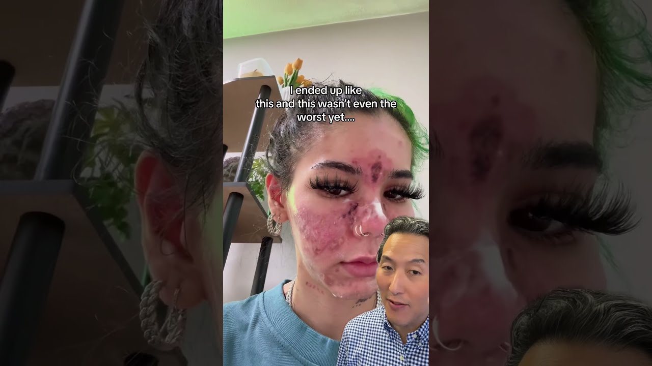 What Happens When You Apply Expired Skin Care Products 
