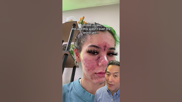What Happens When You Apply Expired Skin Care Products!