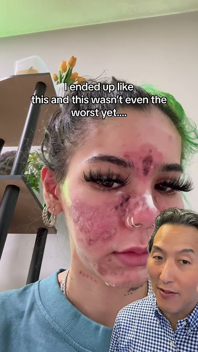 What Happens When You Apply Expired Skin Care Products!