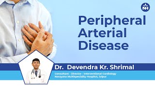 Peripheral Arterial Disease: Symptoms & Treatment | Dr. Devendra Shrimal (Hindi)