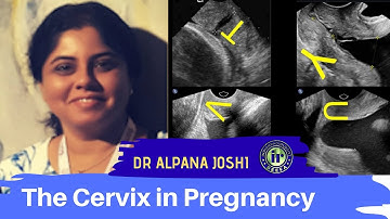 TMT: The Cervix in Pregnancy by Dr Alpana Joshi