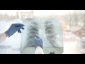 Radiology Basics: How to Spot Pathologies in Chest X-Rays #medicalnotes #anatomy #medicalstudent