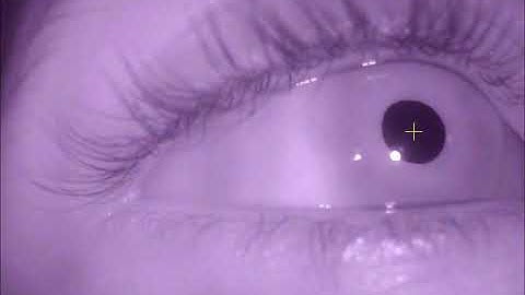 Pupil Detection And Tracking