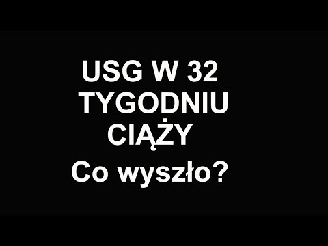 Wideo: Jak Znormalizować Wagę Dziecka