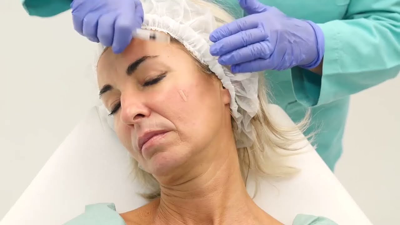 PRX T33 Peel: the ultimate peel without peeling