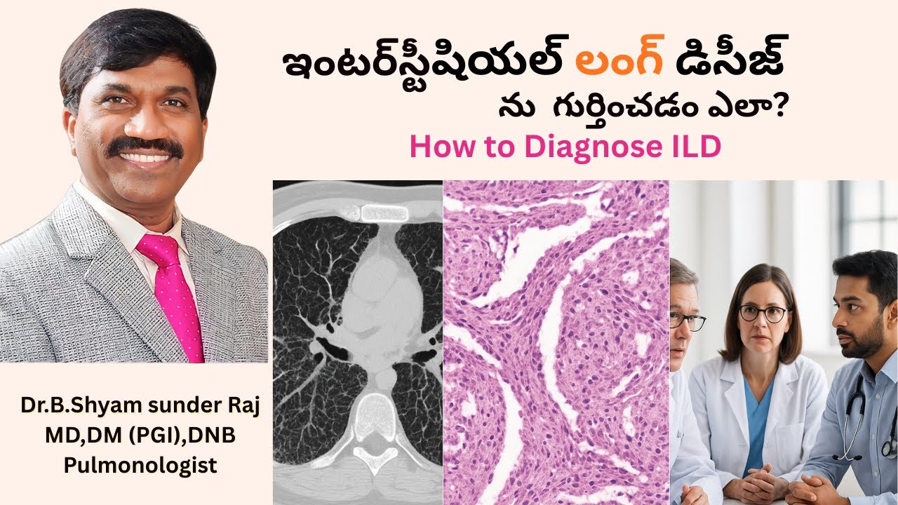 How to Diagnose Interstitial Lung Diseases Dr. B Shyam Sunder Raj | MD ...