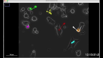Additional Video N°2: Fiji LM2 tracking