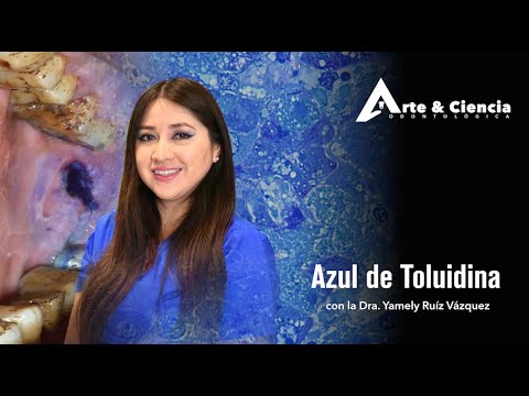 Video: ¿Cómo hacer una solución de azul de toluidina?