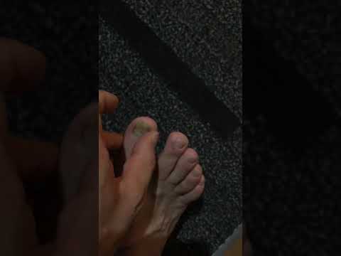 剥がれかけた爪をほっといたら下から新しい爪が古い爪をおしだしてきたので とりあえず取ってみた Youtube 剥がれかけた爪をほっといたら下から新しい爪が古い爪をおしだしてきたので とりあえず取ってみた Youtube