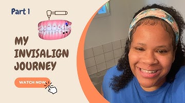 My Invisalign Journey | Part 1 | Exploring my Treatment Plan | Invisalign Treatment