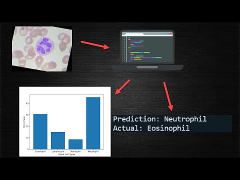 A Model That Classifies Blood Cells | My First Deep Learning Project