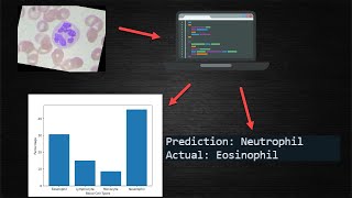 A Model That Classifies Blood Cells | My First Deep Learning Project