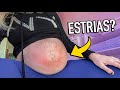 REAÇÃO ALÉRGICA NA BARRIGA | 34 Semanas - Amanda Domenico