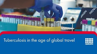 Tuberculosis in the age of global travel