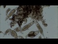 Tpe  observations de microorganismes dans de leau croupie
