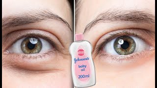 baby oil, remove under-eye wrinkles, under-eye bags, lines around the eyes and dark circles in1 day