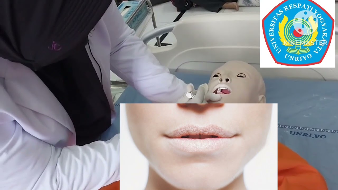 Pemeriksaan Fisik Sistem Hematologi dan Rumpled Tes