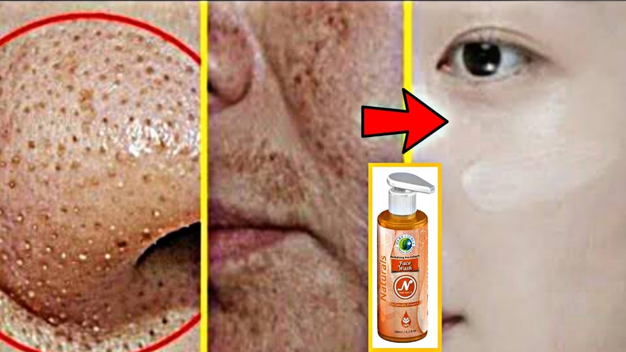 चेहरे की काली परत ऐसे उतरेगी जैसे सालो बाद चेहरा धोयाहो,HERBCIENCE Revitalizng Pro-Collagen Facewash