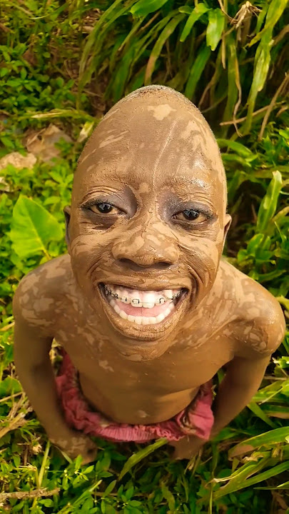 #lifeisbutadream #comedy #ihavethisthingwithplants