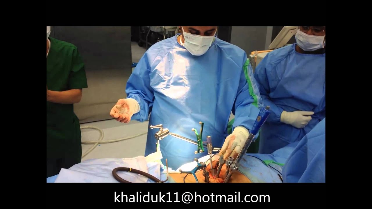 minimal invasive spine fusion with navigation الكويت علم