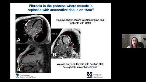 The Cardiologists Perspective