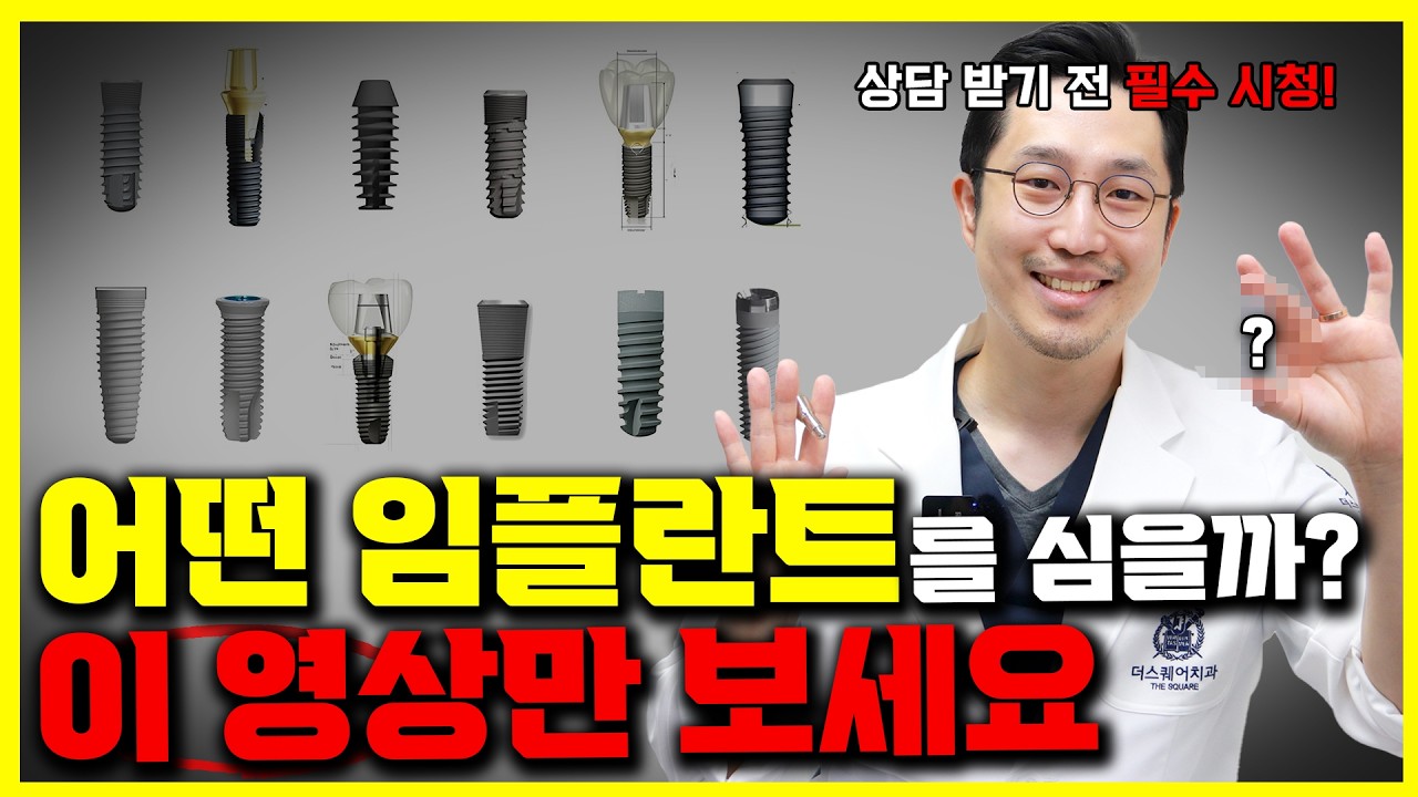 나에게 맞는 임플란트 디자인은 따로 있다?! | ⭐수술 전 필수시청!⭐ 요즘 대세 임플란트 디자인 총정리