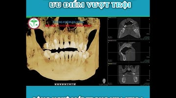 CÔNG NGHỆ MỚI VƯỢT TRỘI TRONG NHA KHOA ĐƯỢC PHÒNG KHÁM ĐA KHOA PHAN CHÂU TRINH ĐƯA VÀO HOẠT ĐỘNG