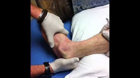 Tree vs Ankle = Dislocation, then Reduction