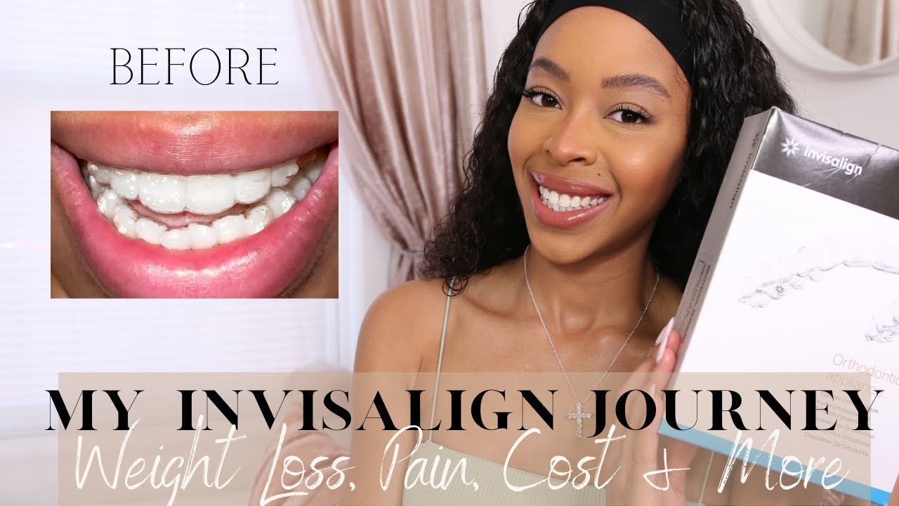 MY INVISALIGN JOURNEY WEIGHT LOSS, COST, PAIN AND THE PROCESS YouTube