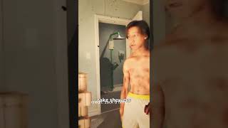 #Teen# Overdoses On Deodorant Spray #😨#