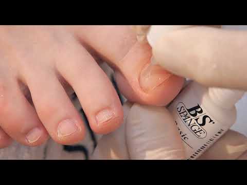 BerndStolz BS SPANGE Quick 16 アプリケーター BerndStolz BS SPANGE Quick 16 アプリケーター B/S Brace
