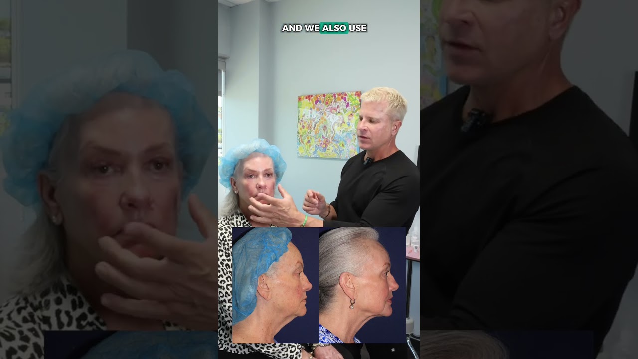 Banner for Dr. Groff shares this patient's Take10 + ThermiSculpt journey.  #Take10 #LaserResurfacing