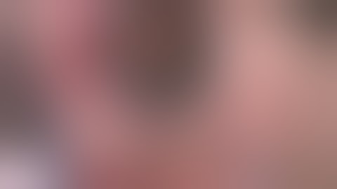 Repair of dislocated CTR and IOL with reforming of the capsular bag by Steven G. Safran MD